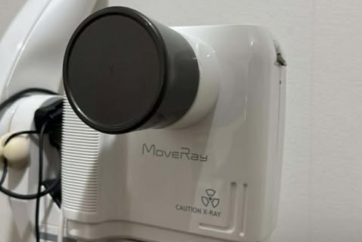 ポータブルレントゲン（MoveRay）