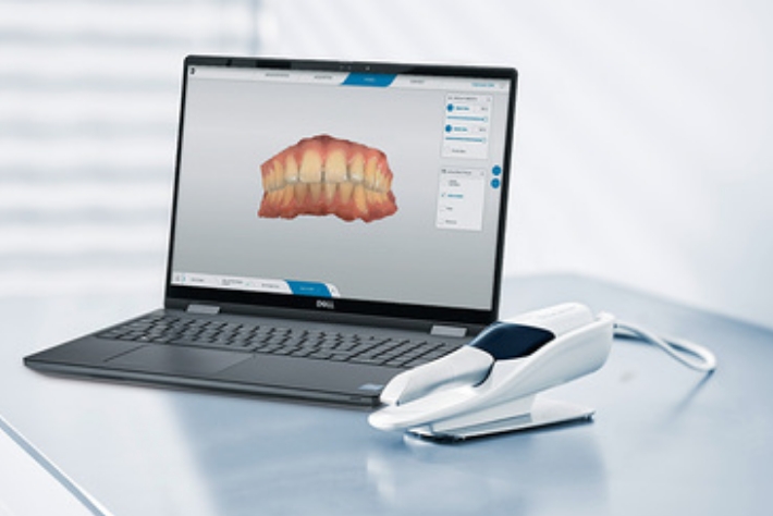 高精度口腔内スキャナー（Primescan）